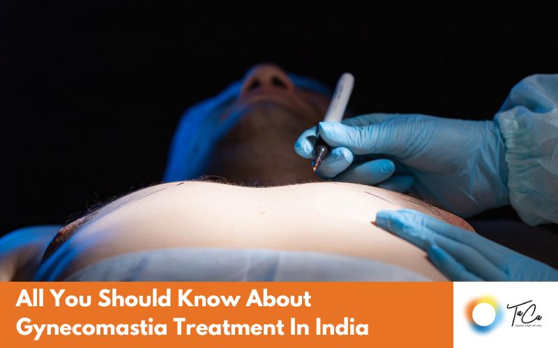 Gynecomastia Treatment In India