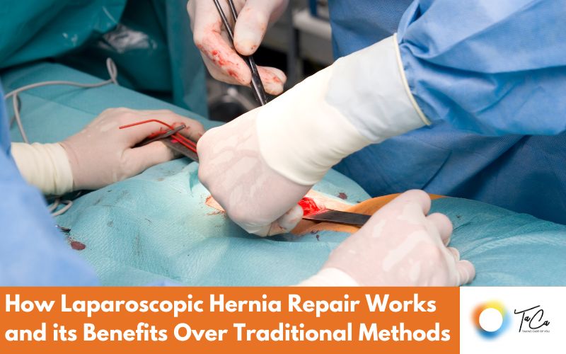 How Laparoscopic Hernia Repair Works and its Benefits Over Traditional Methods