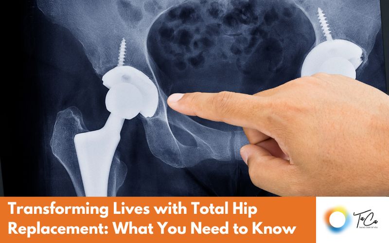 Total Hip Replacement Surgery in india
