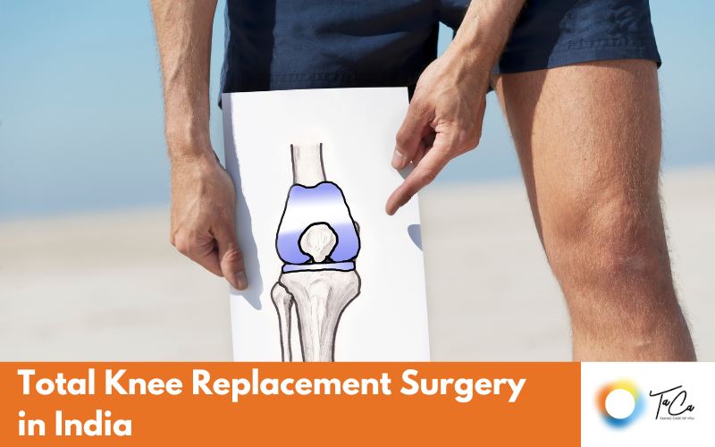 Total Knee Replacement Surgery in India