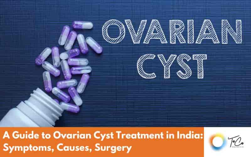 Ovarian Cyst treatment in India